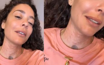 Fajah Lourens laat haar hals straktrekken in kliniek, maar resultaat is schrikbarend