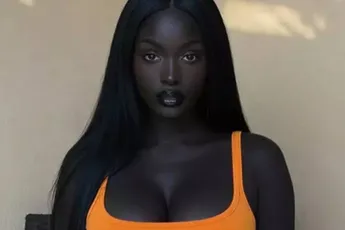 /actua/verontrustende-waarheid-achter-influencer-die-wordt-bestempeld-als-de-knapste-vrouw-ter-wereld