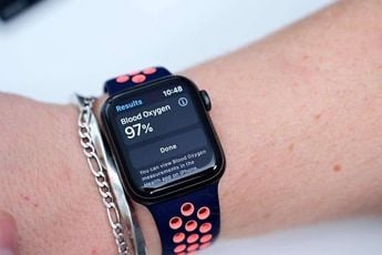 Global Wearables Market: Apple and Huawei Dethroned Xiaomi