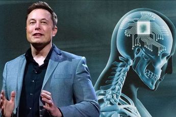 Elon Musk Doesn't Mind To Implant Brain Chips In His Children