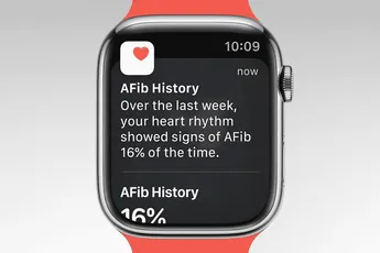 WatchOS 9 gets Canada approval for AFib history feature