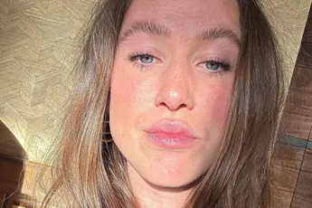 /show-tel/suzanne-schulting-toont-enorme-snee-in-haar-rug