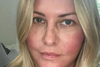 /show-tel/bekende-baywatch-actrice-nicole-eggert-heeft-borstkanker