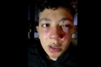 "Ik ben Mounaime, 19 jaar, en werd na de betoging in Brussel door vijf gemaskerde politiemensen in elkaar geslagen"