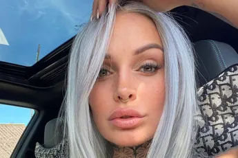 "Ik zie er niet uit!": 'Temptation'-Pommeline deelt eerlijke foto dag na pijnlijke laserbehandeling