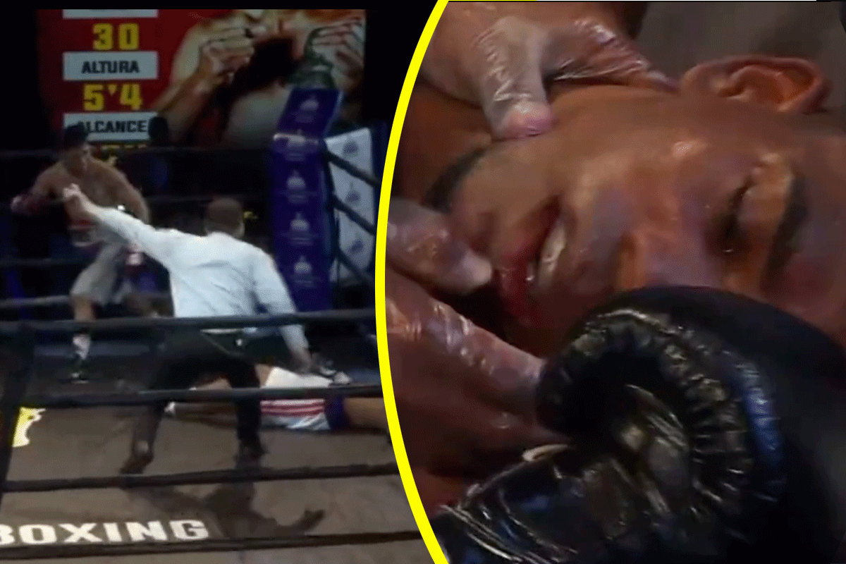 Dodelijke stoot veroorzaakt enge 'KO' in bokswedstrijd (video)