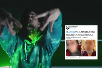 'Hij sloeg me verrot!' Vrouw van Pro-Worstelaar post bewijs foto's