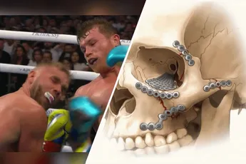 9e ronde had fataal kunnen zijn voor Billy Joe Saunders