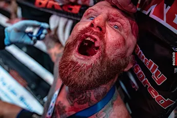 Nederlandse topvechter in bloederige blote vuist boksfinale