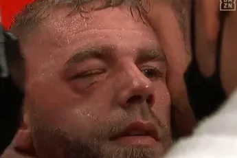 AANSTELLER: Blondje twijfelt over dichtgeslagen oog Saunders