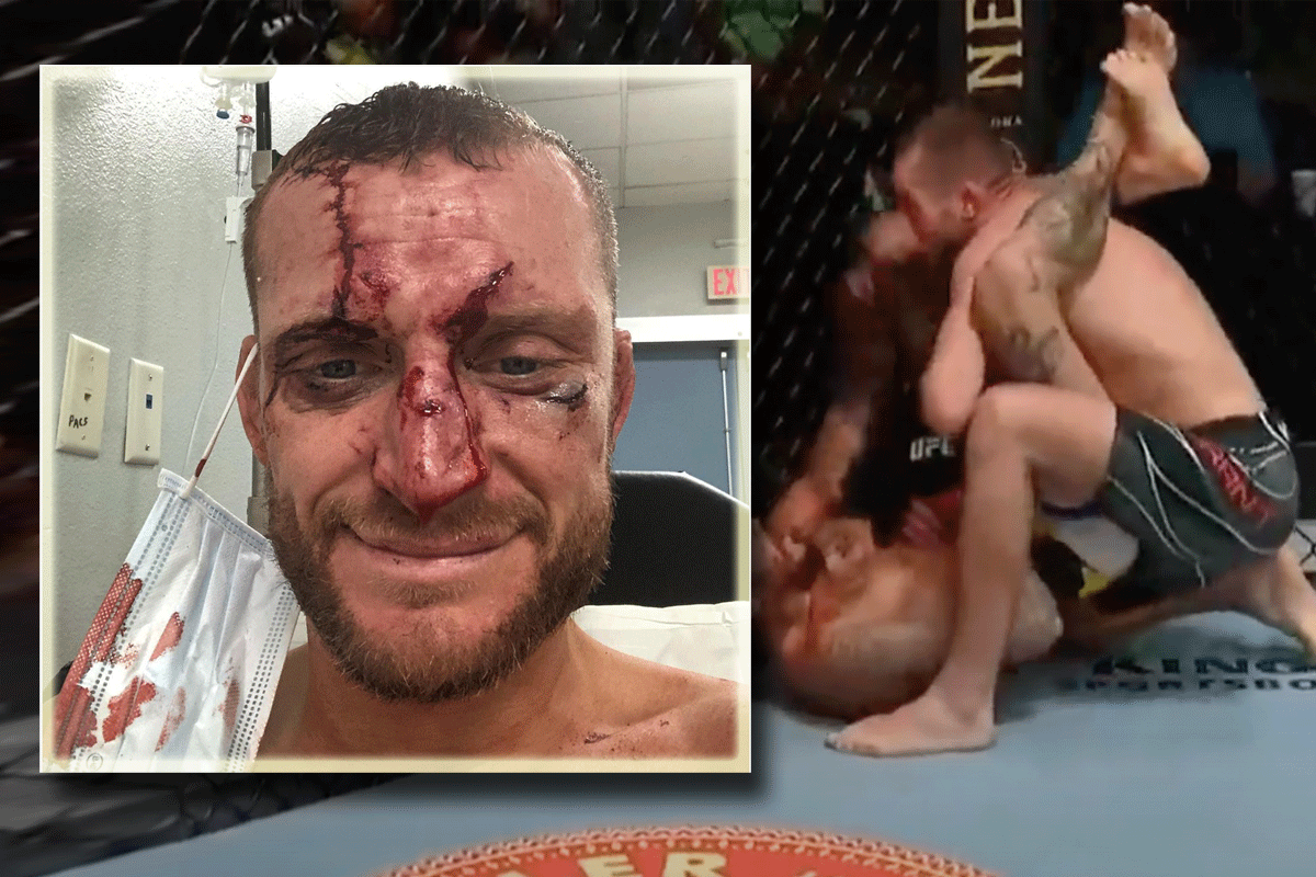 UFC vechter knokte door ondanks gebroken kaak (video)