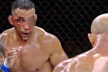 🎥 'Oog tot pulp geslagen!' Ex-UFC ster Werdum overleeft maar net bloederig gevecht tegen Dos Santos