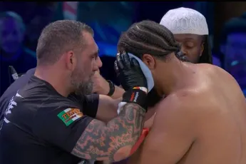 🎥 Oog bokser explodeert! Einde van bokscarrière na beschamende eerste nederlaag?