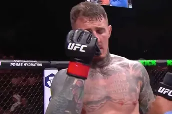 ‘Oog eruit door vieze nagels?’ – schokkend onderzoek na UFC-incident