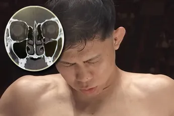 Operatie moest meteen – Oog topvechter dreigde af te sterven, gevecht afgeblazen