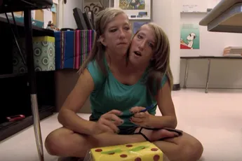 Siamese tweeling Abby en Brittany hebben een baan