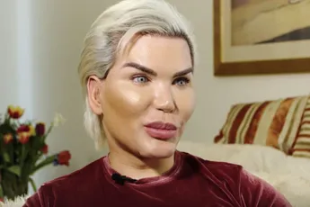 The Human Ken Doll liet even 4 ribben verwijderen