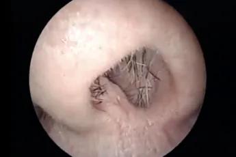 Dokter op bloedzuiger jacht in man zijn gok