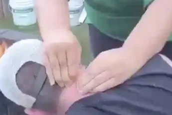 Enorme puist heeft wel wat weg van confetti-kanon