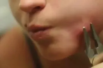 Even de kern van een pukkel uit je wang trekken