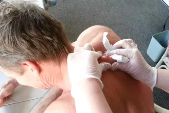 Dag puist van 30 jaar: Zo'n grote pusbal jonge! BAM!