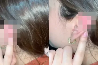 De bedoeling was een piercing, maar kan nu zo meedoen met Star Trek