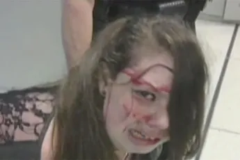 Deels doof, blind en verlamd meisje met kanker hard aangepakt door TSA