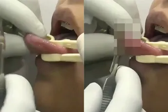 Internet kan uit: Zo wordt een gespleten tong gemaakt