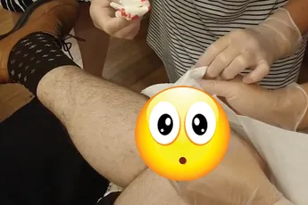 Ja hoor, we hebben een spuitertje met mayonaise uit iemand zijn been