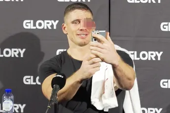 Gezichtsherkenning op telefoon van toegetakelde Rico Verhoeven werkt niet meer