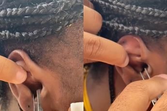 Vrouw heeft na snorkelen krab als huisdier in haar oor