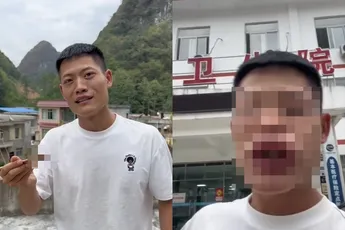 Niet slim om je te laten steken door een wesp, maar je hebt nu wel een Ex on the Beach lip