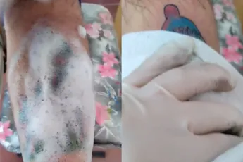 Hopelijk is Spider-Man fan blij met zijn tatoeage