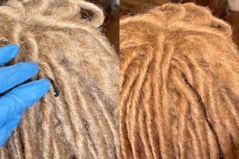 Dreadlocks blijken een fantastisch nest voor ongedierte