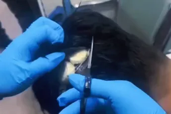 Colombiaanse drugskoerier was onderweg naar Amsterdam, maar gesnapt met cocaïne in zijn pruik