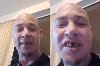 Kevin heeft dé manier om te besparen op de tandarts