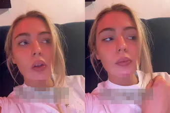 Jutta Leerdam deelt video: gewond geraakt door bestuurder die op z’n telefoon zat