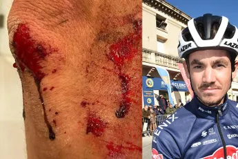 Richardson op brute wijze aangevallen en beroofd: 'Ze trokken een 15 inch machete'