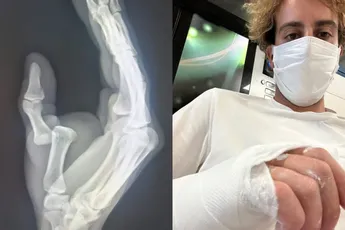 📸 Niet voor de nuchtere maag! Duim van gestopte Fabio Aru neemt afslag naar links tijdens training
