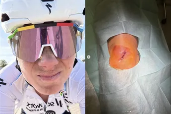 Kopecky in eerste instantie ontslagen uit ziekenhuis, maar later blijkt schade toch veel groter dan gedacht