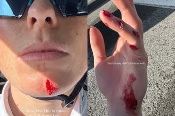 Ai! Demi Vollering hard onderuit tijdens trainingskamp met FDJ-SUEZ in Spanje en deelt de schade