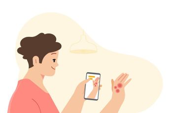 Zo gaat Google jou helpen om huidkanker op te sporen