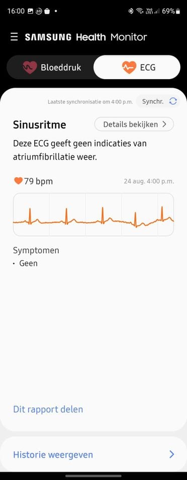 Iwatch 5 sales ekg app