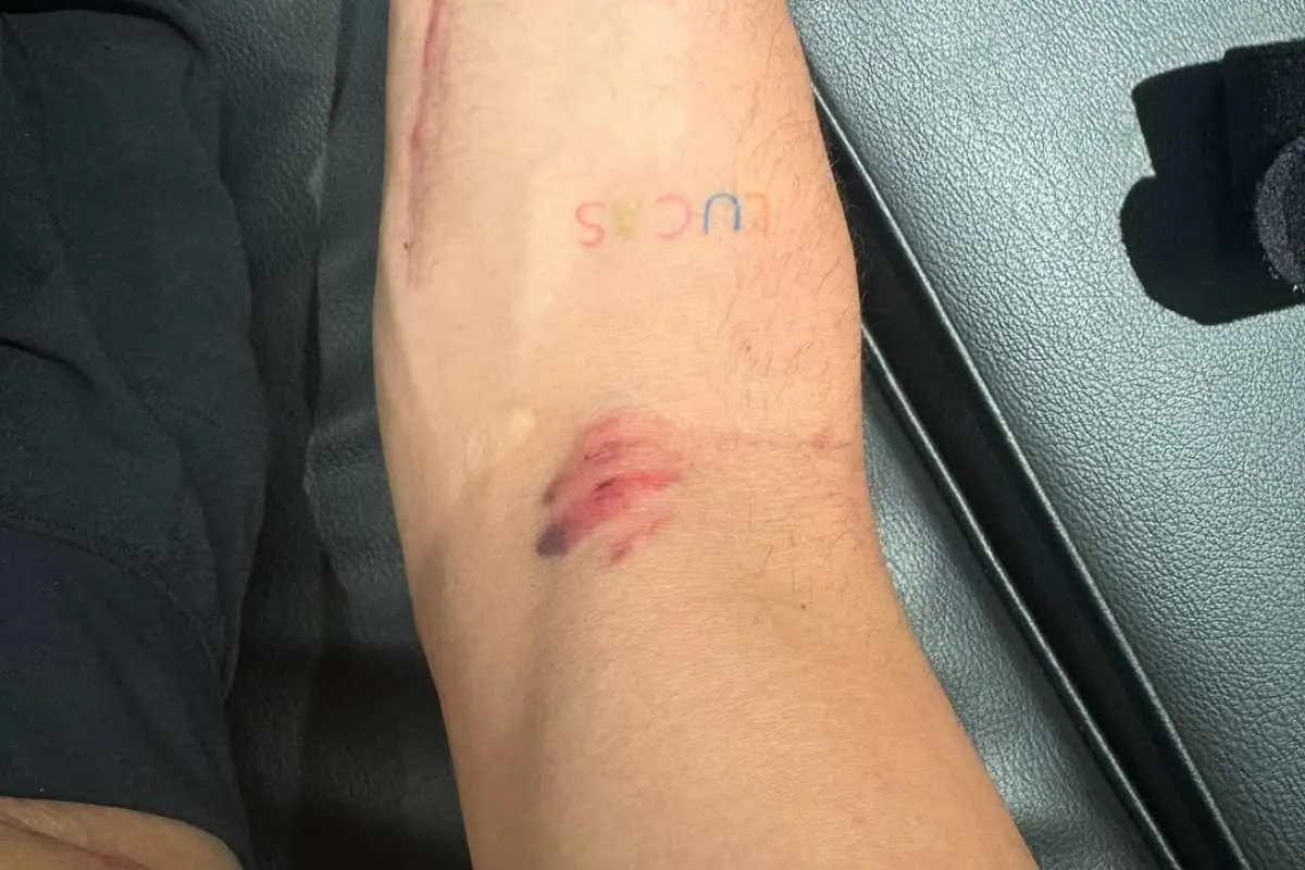 alex rins yamaha motogp braccio