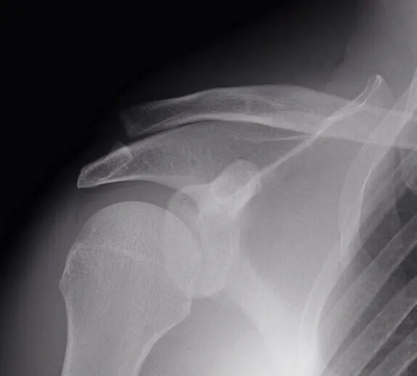 sylvain guintoli injury update 2