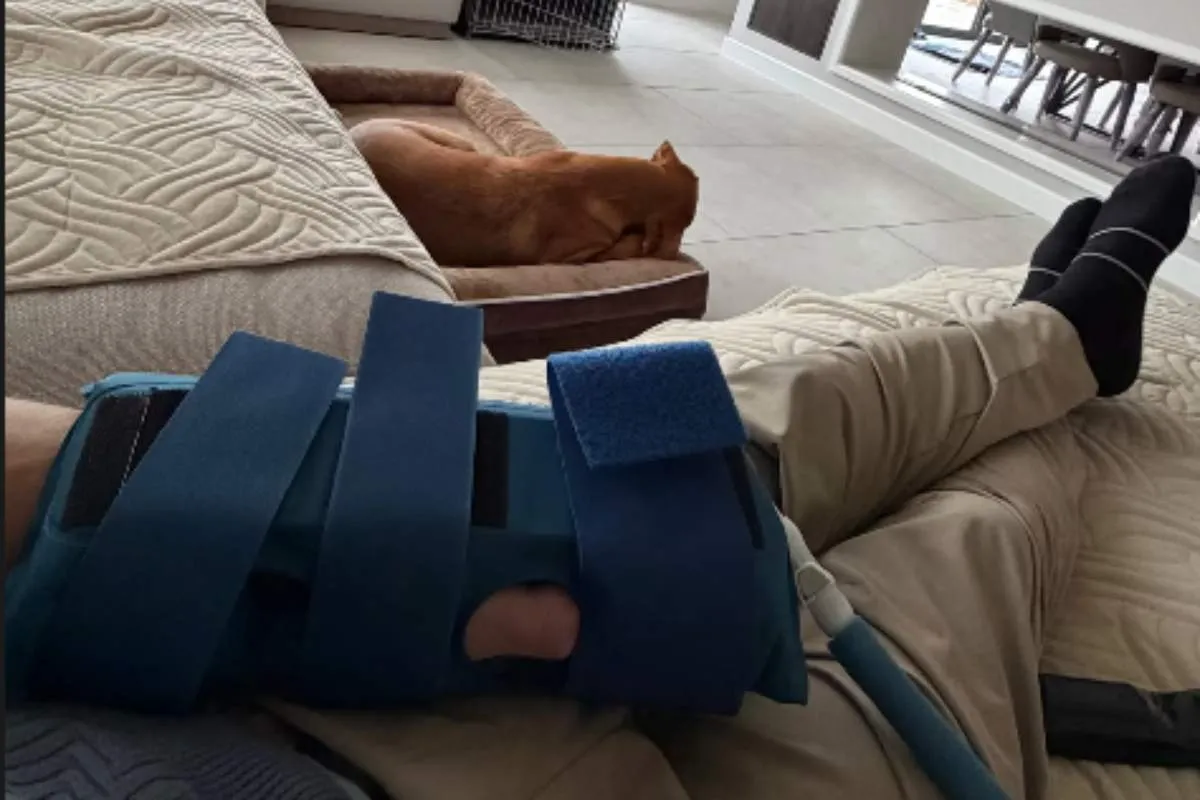 La mano infortunata di Sam Lowes, pilota team Marc VDS Superbike WorldSBK