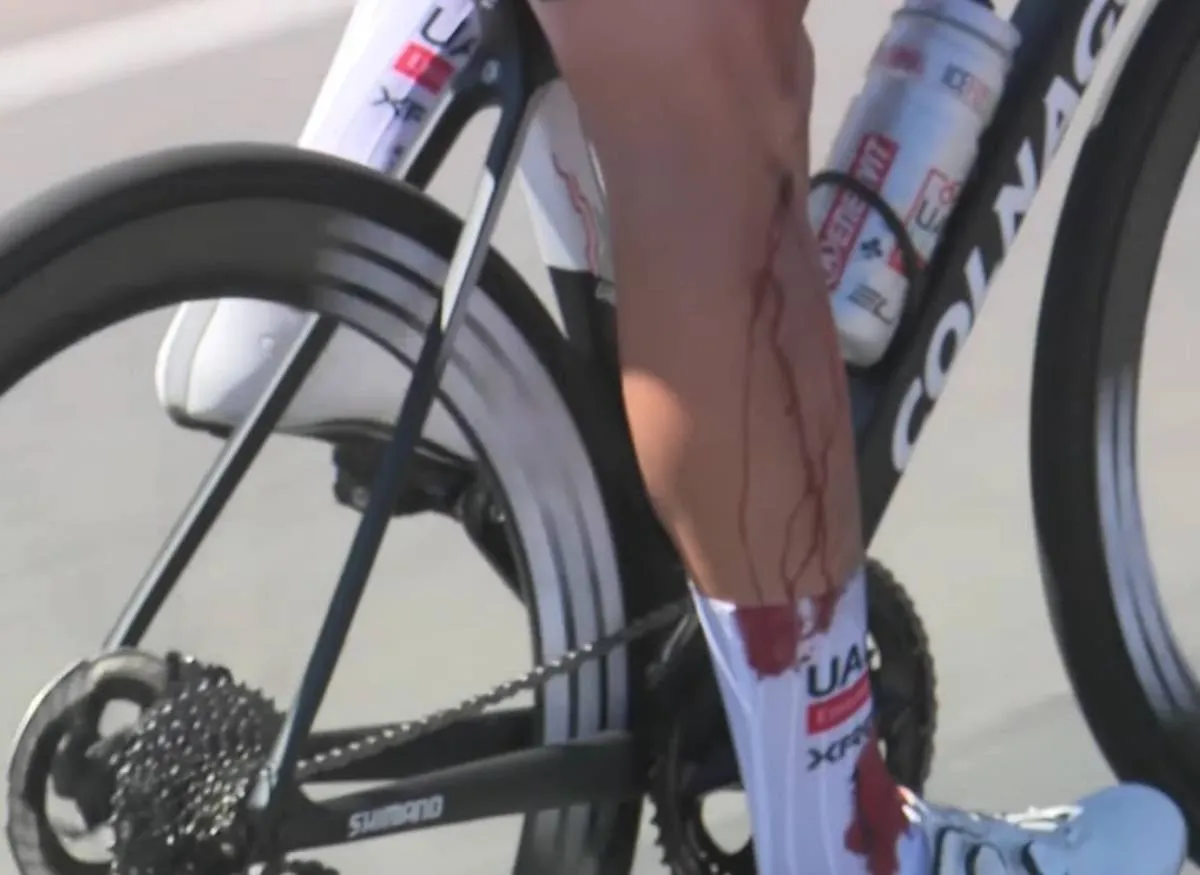 Relatório médico e abandonos - Tour Down Under 2025 4ª etapa: Jay Vine novamente envolvido numa queda