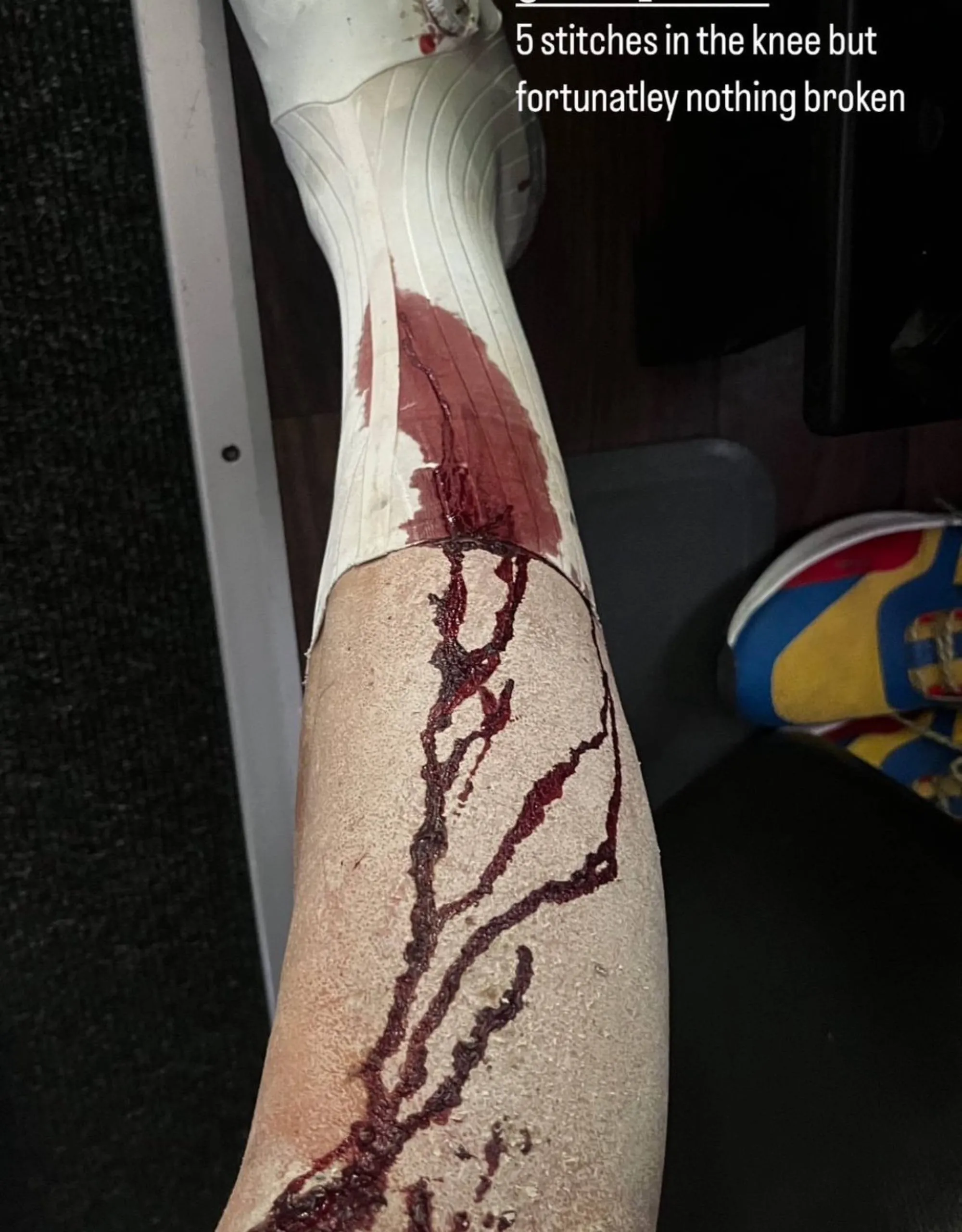 Mathias Vacek abandonou a Strade Bianche e levou cinco pontos num joelho: "Felizmente não tenho nada partido"