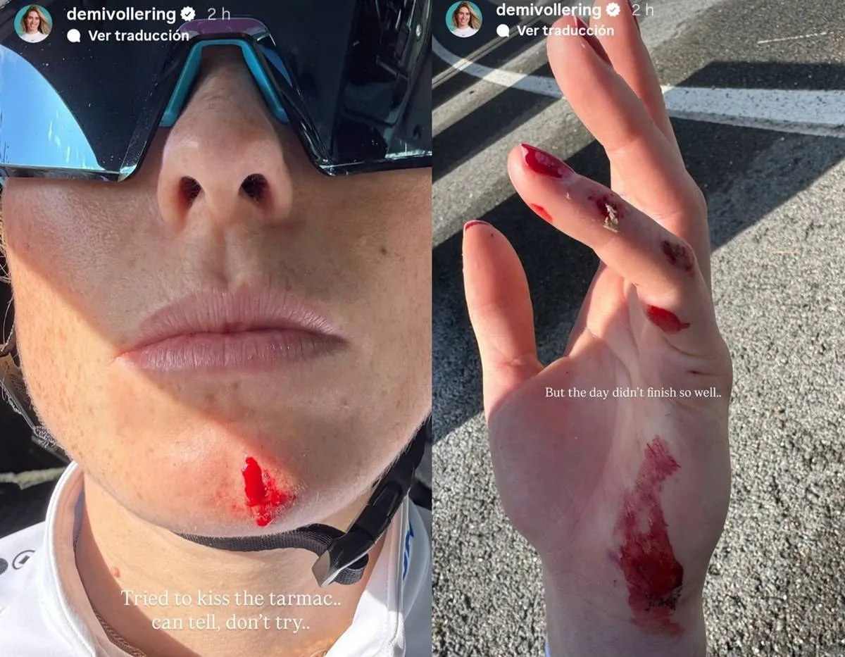 Demi Vollering with blood after a training crash