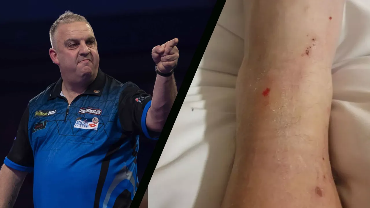 Multiple World Championship participant forced to flee hotel room citing infestation of bedbugs